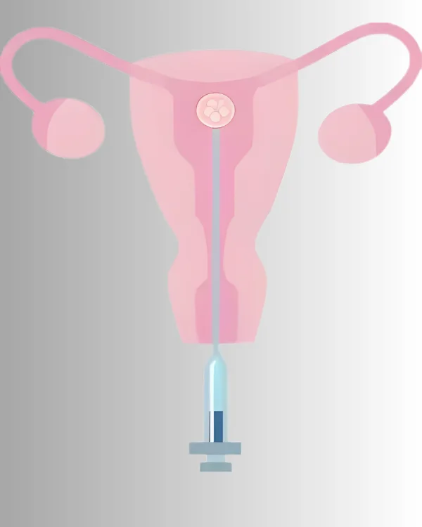 Best Intrauterine insemination (IUI) – Dr. Prodduturu Padmaja